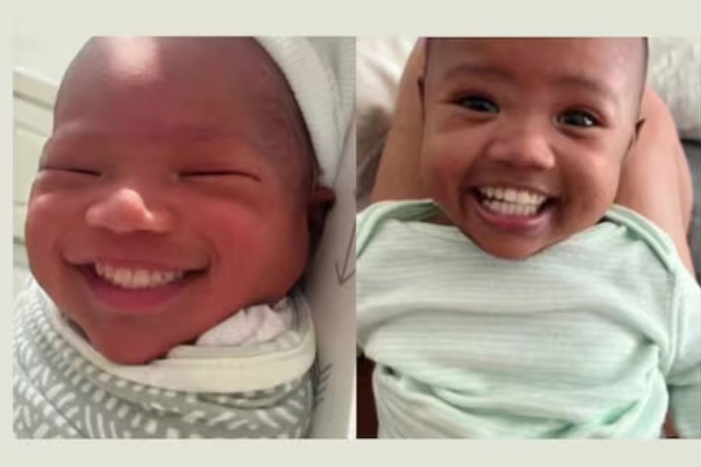 Viral Video baby born with full set of Teeth