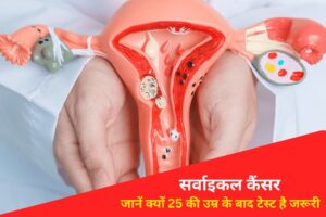 Cervical Cancer